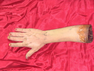 Fake arm with missing finger tips from Curse of the Queerwolf